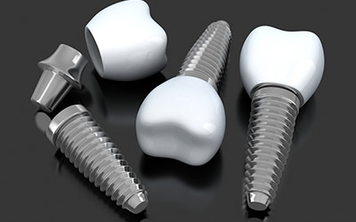 Teeth Implants Services Gurgaon