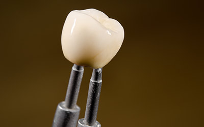 Dental Crowns Services Gurgaon