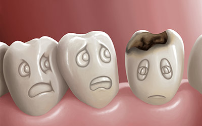Causes of Dental Decay, Enamel and Dentine